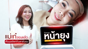 คุณเก๋ 60 ยังกล้า! ลูกชายหล่อขึ้นจนต้องตามหา “โปรแกรมหน้ายุง Prime” จาก “Dermatige” เห็นผลลัพท์กับตาตัวเอง